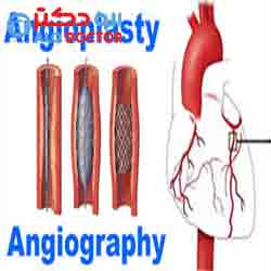 چگونه بیمار قلبی بدون آنژیوگرافی و به کمک طب سنتی درمان شود؟!
