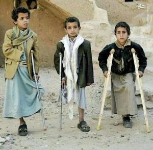 عکس/ سه کودک یمنی با سه پا