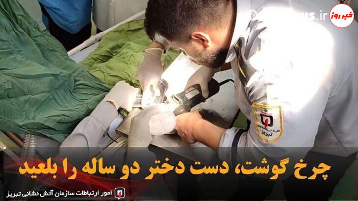 چرخ گوشت، دست دختر ۲ ساله را بلعید