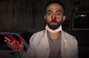 ضرب وشتم خبرنگار تبریزی نهایتا به شکستن بینی این خبرنگار منتهی شد