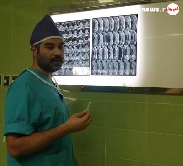جراحی موفقیت آمیز تومور نخاعی برای اولین بار در بیمارستان ۲۲ بهمن مسجدسلیمان