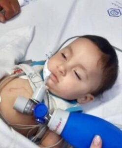 نجات جان کودک ۸ ماهه با تلاش تیم پزشکی بیمارستان عالی نسب تبریز