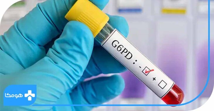 آزمایش G۶PD Quantitative و حساسیت به باقالا