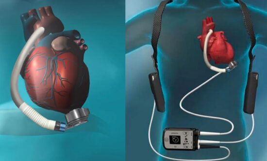 این زن آمریکایی نبض ندارد و با باتری زندگی می‌کند