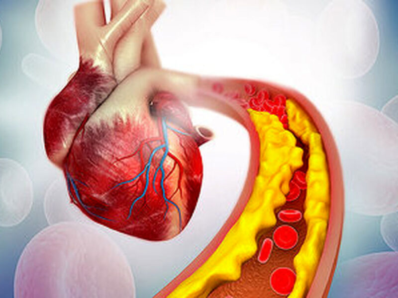 بهترین پیشنهاد برای کاهش کلسترول خون