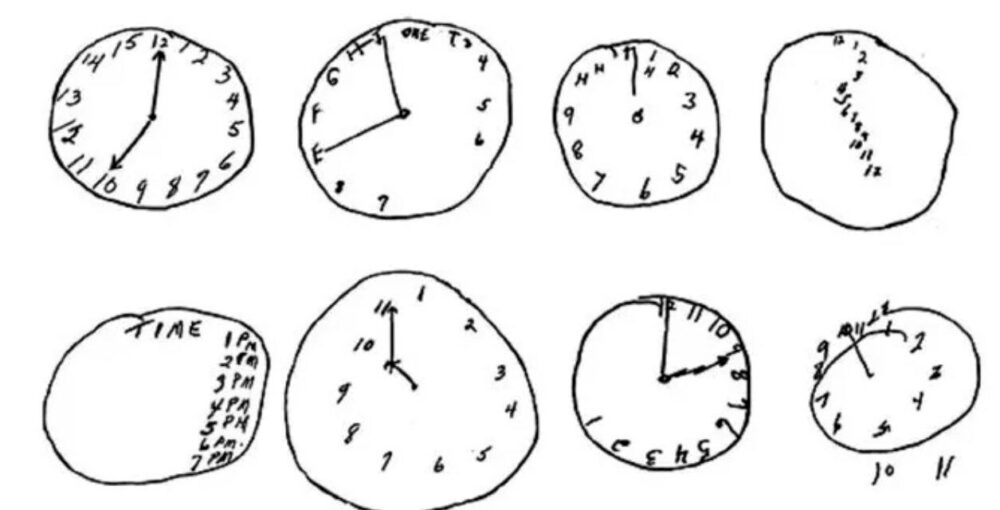 آزمایش ساده ۶۰ ثانیهای برای تشخیص علایم اولیه زوال عقل