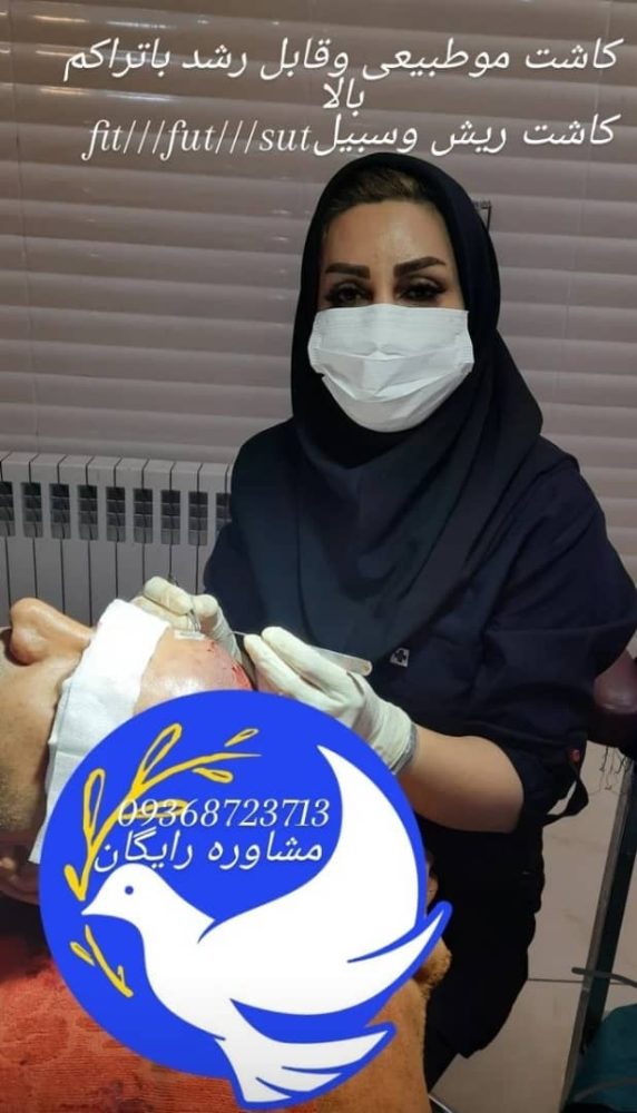 گفتگو اختصاصی با محبوبه مرادی کارشناس و مشاور کاشت مو
