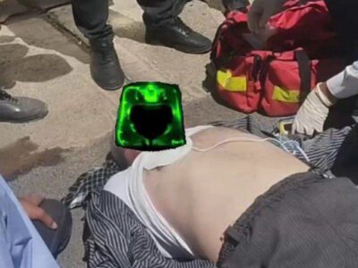 احیای موفق مرد ۶۰ ساله در جدال مرگ و زندگی/بیمار بدون قلب به زندگی بازگشت