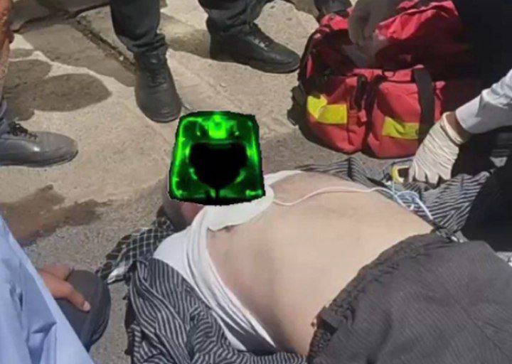 احیای موفق مرد ۶۰ ساله در جدال مرگ و زندگی/بیمار بدون قلب به زندگی بازگشت