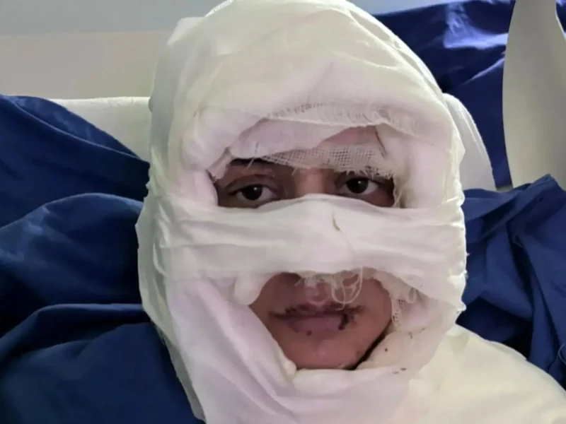 زنی در استانبول به اتهام سوزاندن چهره یک زن جوان روانه زندان شد